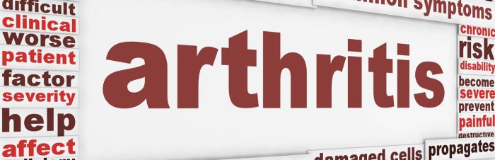 Managing arthritis pain