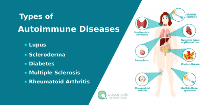 Autoimmune diseases and management