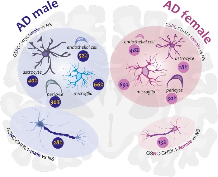 Latest research on Alzheimer's disease