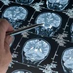 Latest research on Alzheimer's disease